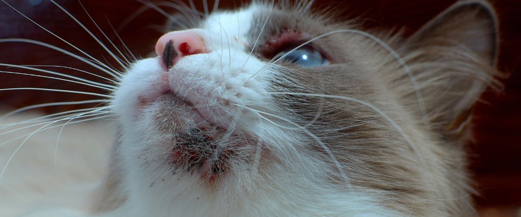 A chat with chin acne